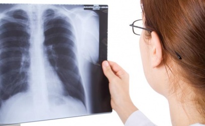 【產前須知】哺乳期間可以照X光嗎？