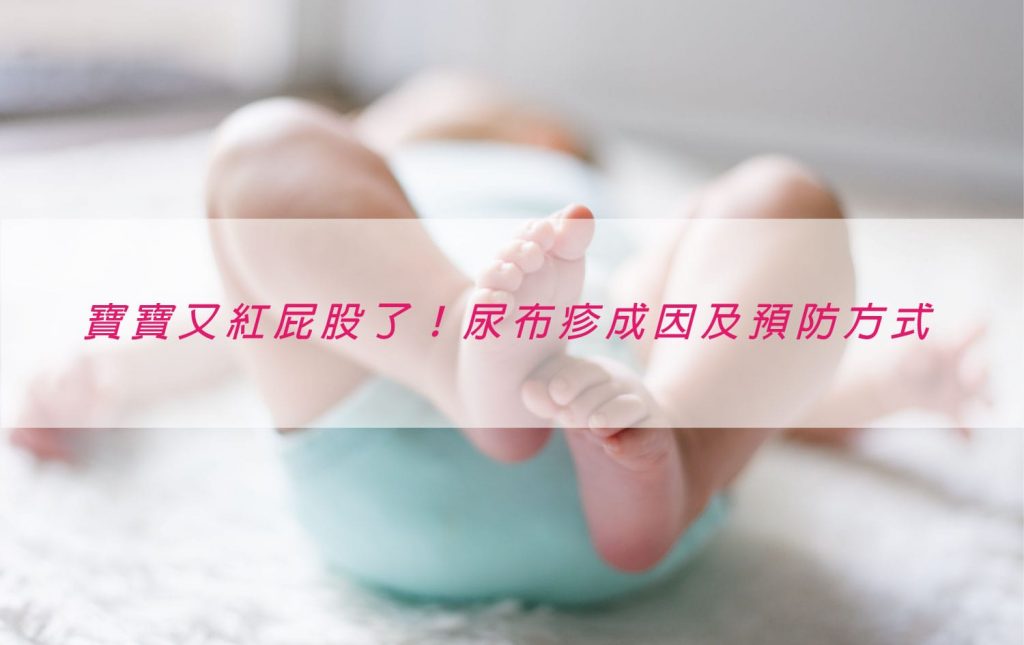 【育兒常識】尿布疹的分類