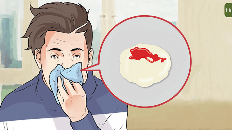 【育兒常識】爸媽必看！小心「黴漿菌肺炎」感染